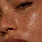 Microneedling (E-pen)